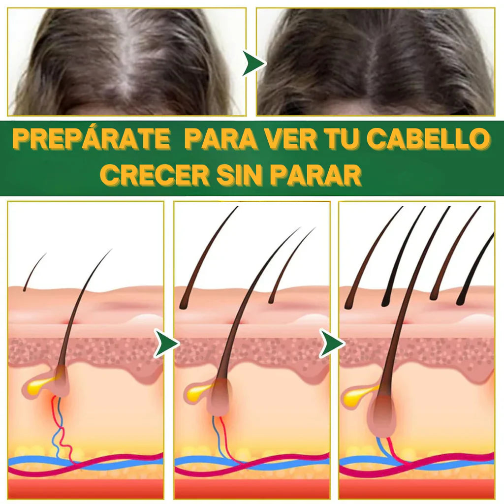 OUHOE - CONTRA LA CAÍDA DE CABELLO