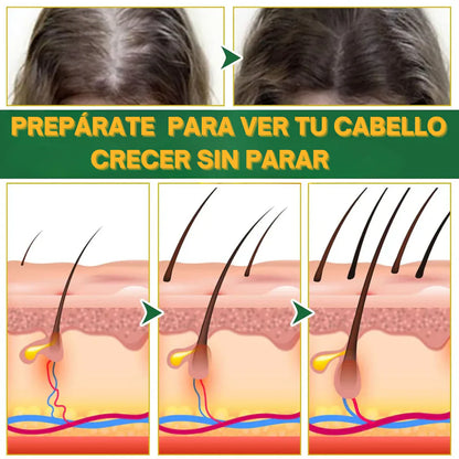 OUHOE - CONTRA LA CAÍDA DE CABELLO